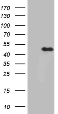 Monoclonal Mouse anti-Human E2F5 Antibody (clone OTI3B7, WB)