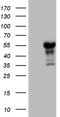 LHX4 Antibody (aa1-260, clone OTI4E11)
