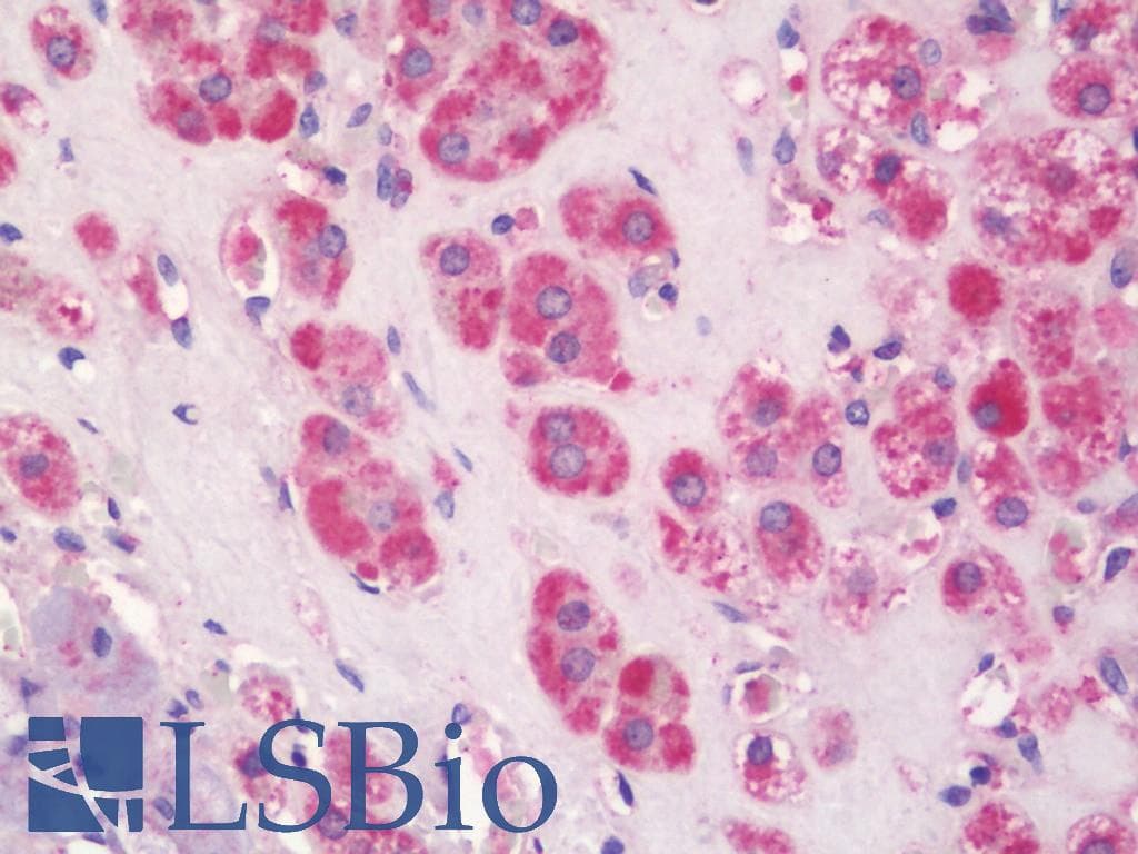 IHC-plus™ Polyclonal Rabbit anti-Human SLC16A2 / MCT8 Antibody (aa93-142, IHC, WB)
