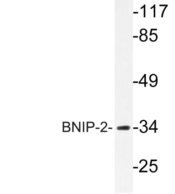 BNIP2 Antibody (aa73-122)
