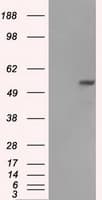 Monoclonal Mouse anti-Human FH / Fumarase / MCL Antibody (clone OTI1F10, IHC, IF, WB)