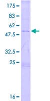 Human TSPYL4 Protein (Recombinant GST)