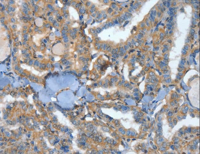 ATP4B Antibody