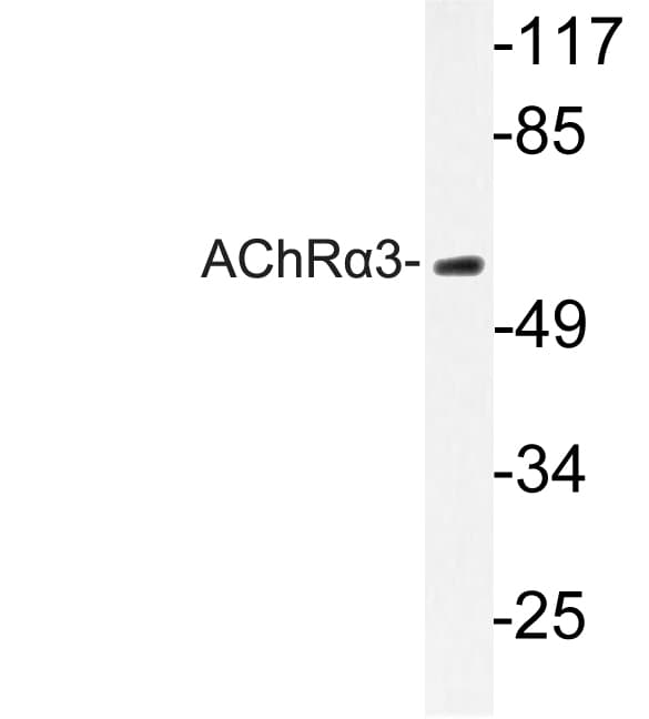 CHRNA3 Antibody (Leu139)