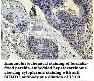 Polyclonal Rabbit anti-Human SUMO3 Antibody (aa2-103, IHC, WB)