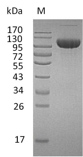Human FGFR3 Protein (Recombinant Fc, C-terminus)