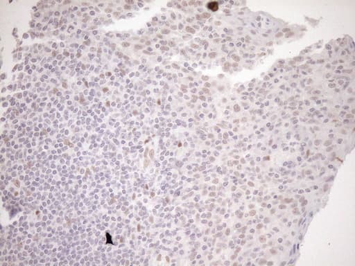 NR1H3 / LXR Alpha Antibody (aa69-329, clone OTI1A5)