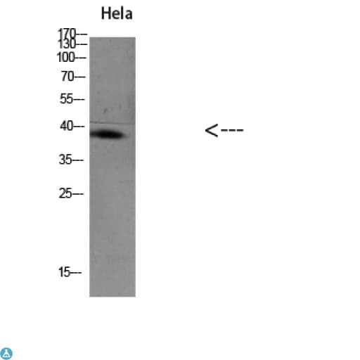 HAVCR1 / KIM-1 Antibody