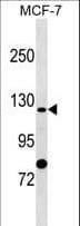 Polyclonal Rabbit anti-Human SLC4A9 / AE4 Antibody (aa2-30, WB)