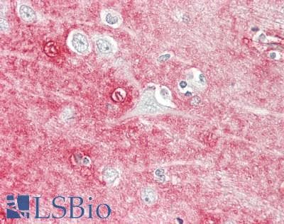 IHC-plus™ AQP4 / Aquaporin 4 Antibody