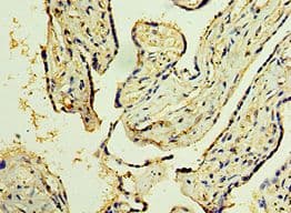Trimethylguanosine Synthase 1 Antibody (aa714-853)
