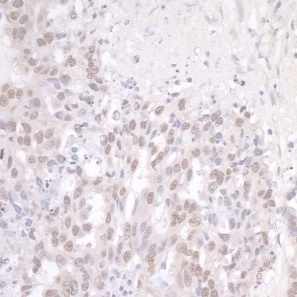 FUS / TLS Antibody (aa1-50)