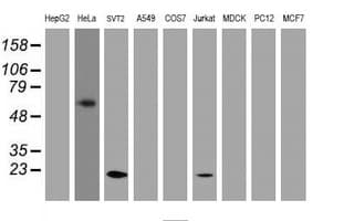 IHC-plus™ TAGLN / Transgelin / SM22 Antibody (clone 8C8)