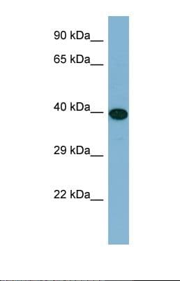 ERCC6L2 Antibody (aa535-584)