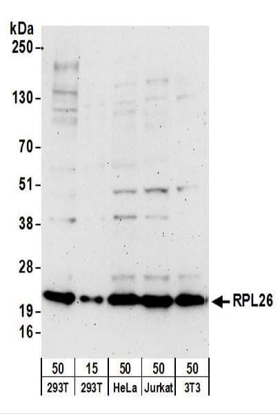 IHC-plus™ RPL26 / Ribosomal Protein L26 Antibody (aa95-145)