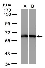 ME1 / Malate Dehydrogenase Antibody (aa161-519)