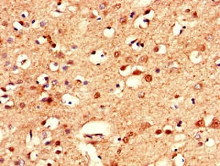 CLSTN2 / Calsyntenin 2 Antibody