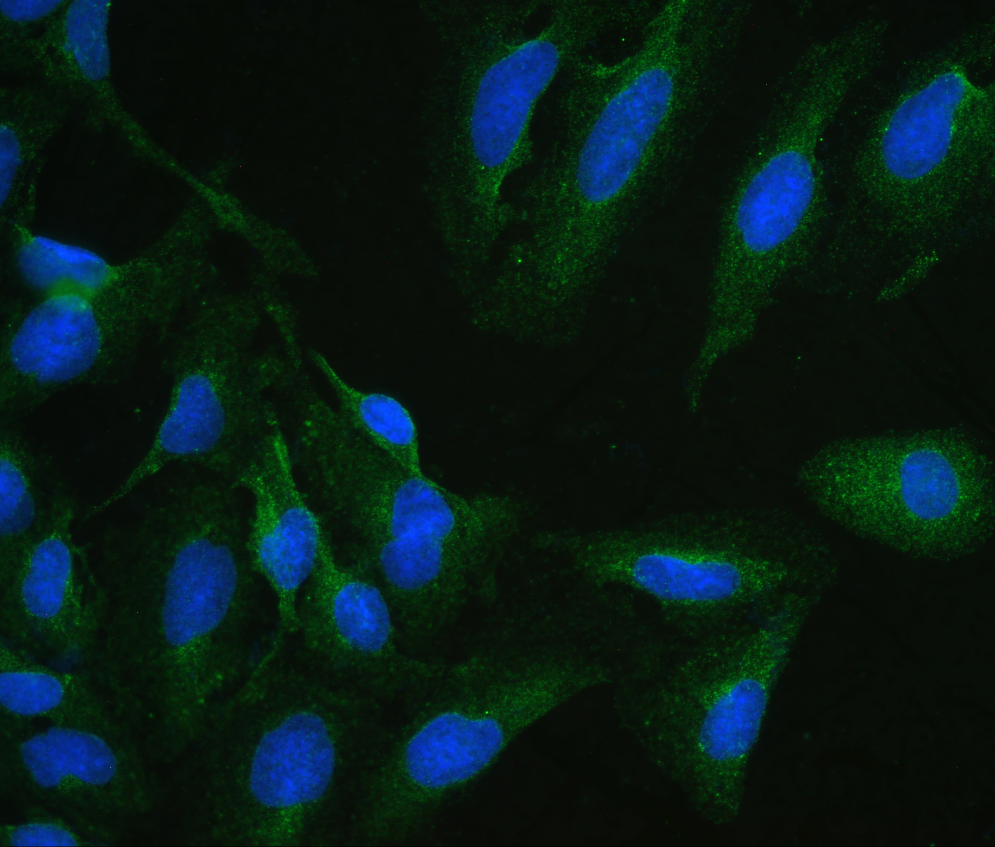 ARSA / Arylsulfatase A Antibody (aa454-482)