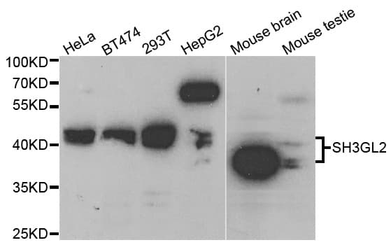 IHC-plus™ Polyclonal Rabbit anti-Human SH3GL2 Antibody (IHC, IF, WB)