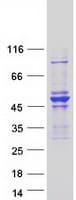 Human ARHGAP8 Protein (Recombinant Myc-DDK (Flag))