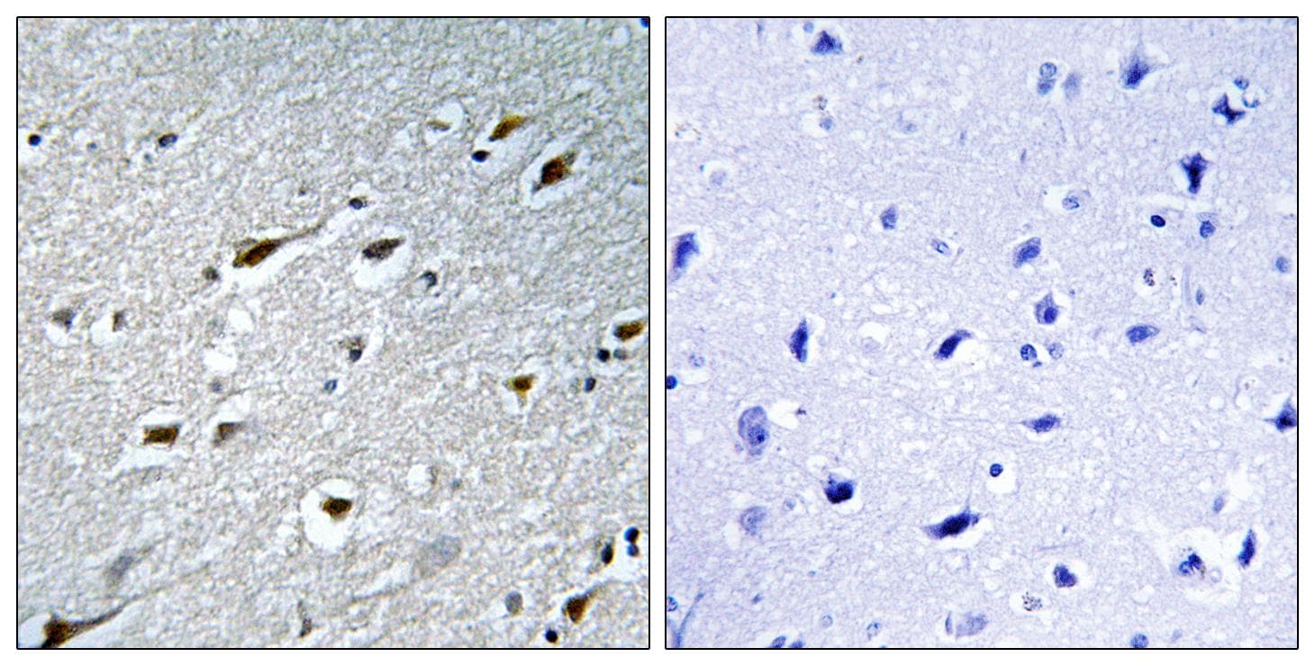 HAND1 Antibody