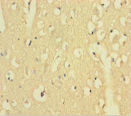 Polyclonal Rabbit anti-Human AFTPH Antibody