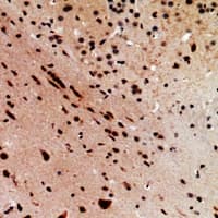 UBE2A Antibody