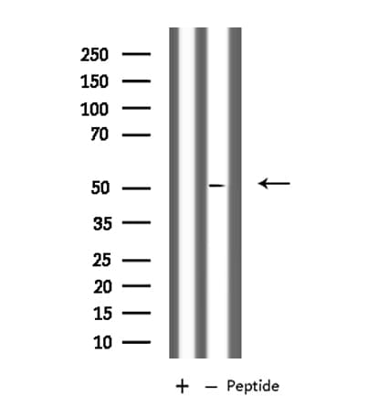 Polyclonal Rabbit anti-Human PLD4 / Phospholipase D4 Antibody (IF, WB)