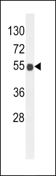 Polyclonal Rabbit anti-Human B3GNT6 Antibody (aa146-173, IHC, WB)