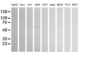 Monoclonal Mouse anti-Human ALDH1A3 Antibody (clone OTI4E8, IHC, WB)