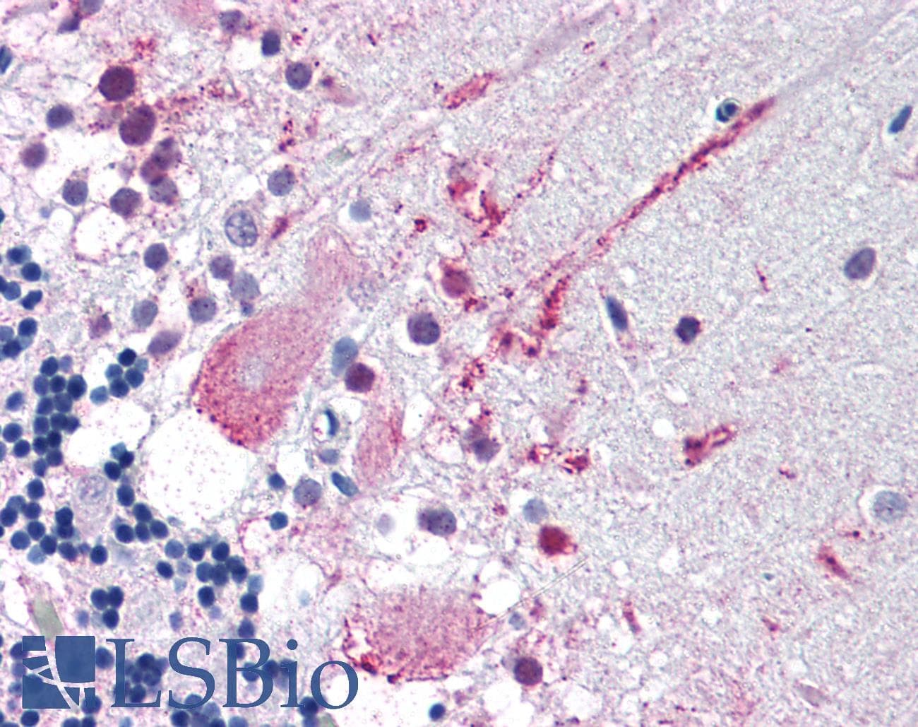 IHC-plus™ Polyclonal Rabbit anti-Human MRGPRF Antibody (C-Terminus, IHC)