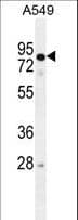 Polyclonal Rabbit anti-Human RAD17 Antibody (aa218-246, WB)