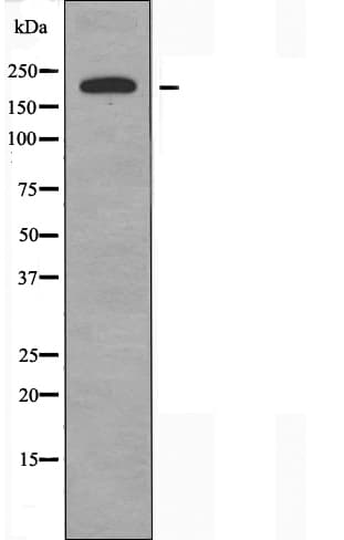 Polyclonal Rabbit anti-Human SCN4A / Nav1.4 Antibody (IF, WB)