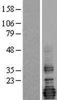 LMO4 Protein (Over-Expression Lysate Myc-DDK (Flag))
