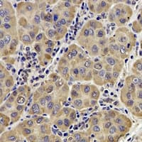 Polyclonal Rabbit anti-Human AP1M2 Antibody (IHC, WB)