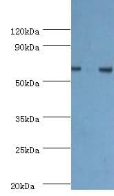 Polyclonal Rabbit anti-Human PDPK1 / PDK1 Antibody (aa277-556, IHC, WB)