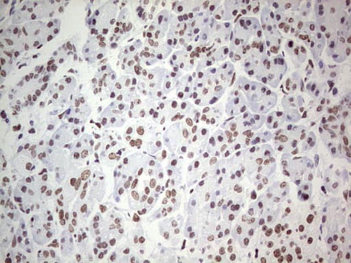 PPP1R8 / Rnase E Antibody (aa1-225, clone OTI5H9)