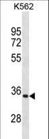 PRTN3 / Myeloblastin Antibody (aa228-256)