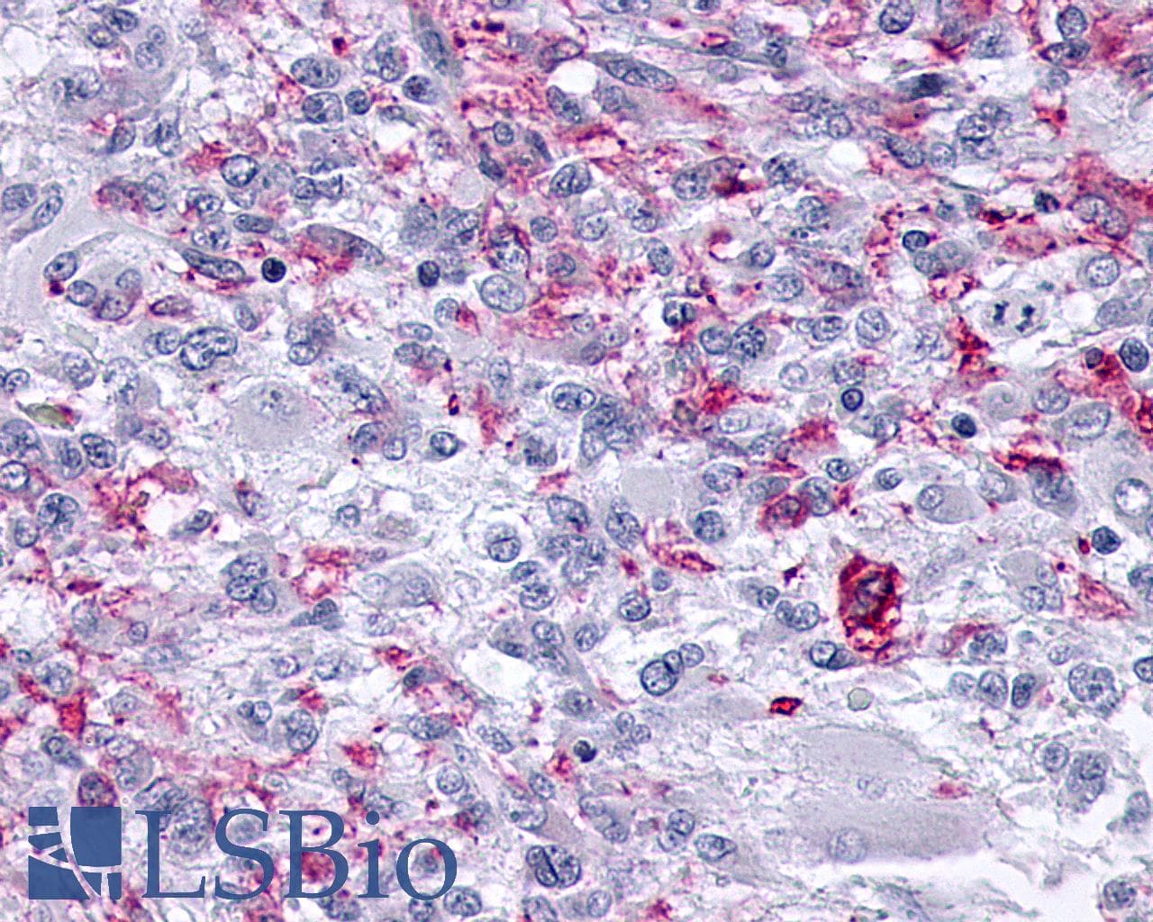 PathPlus™ OPRM1 / Mu Opioid Receptor Antibody (C-Terminus)