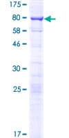 Human SRFBP1 Protein (Recombinant GST)