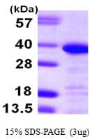 Human ANXA13 / Annexin XIII Protein (Recombinant His)