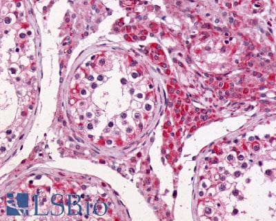 PathPlus™ ADGRG2 / GPR64 Antibody (C-Terminus)