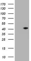 MUC16 / CA125 Antibody (clone OTI2F1)