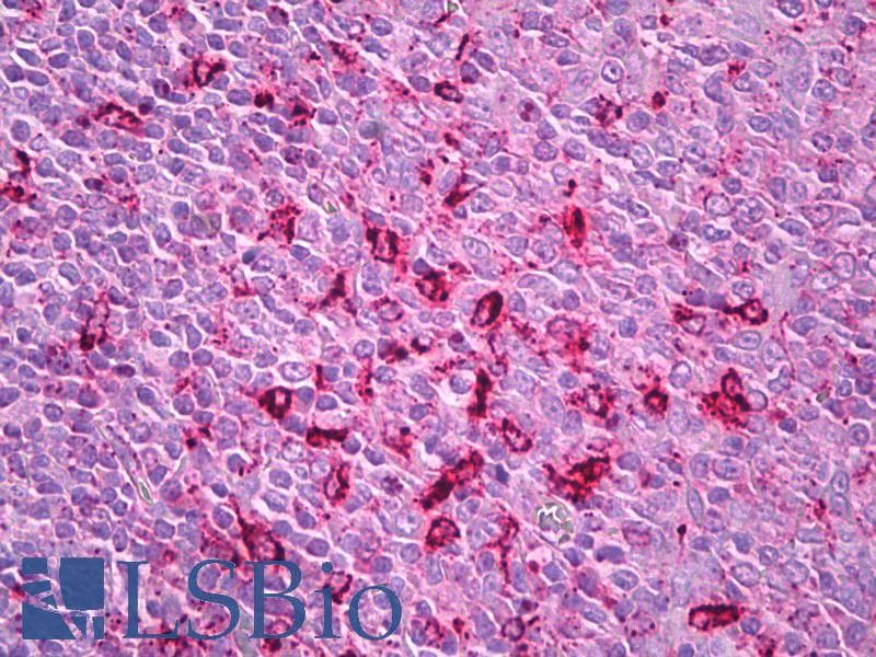 PathPlus™ CTSS / Cathepsin S Antibody
