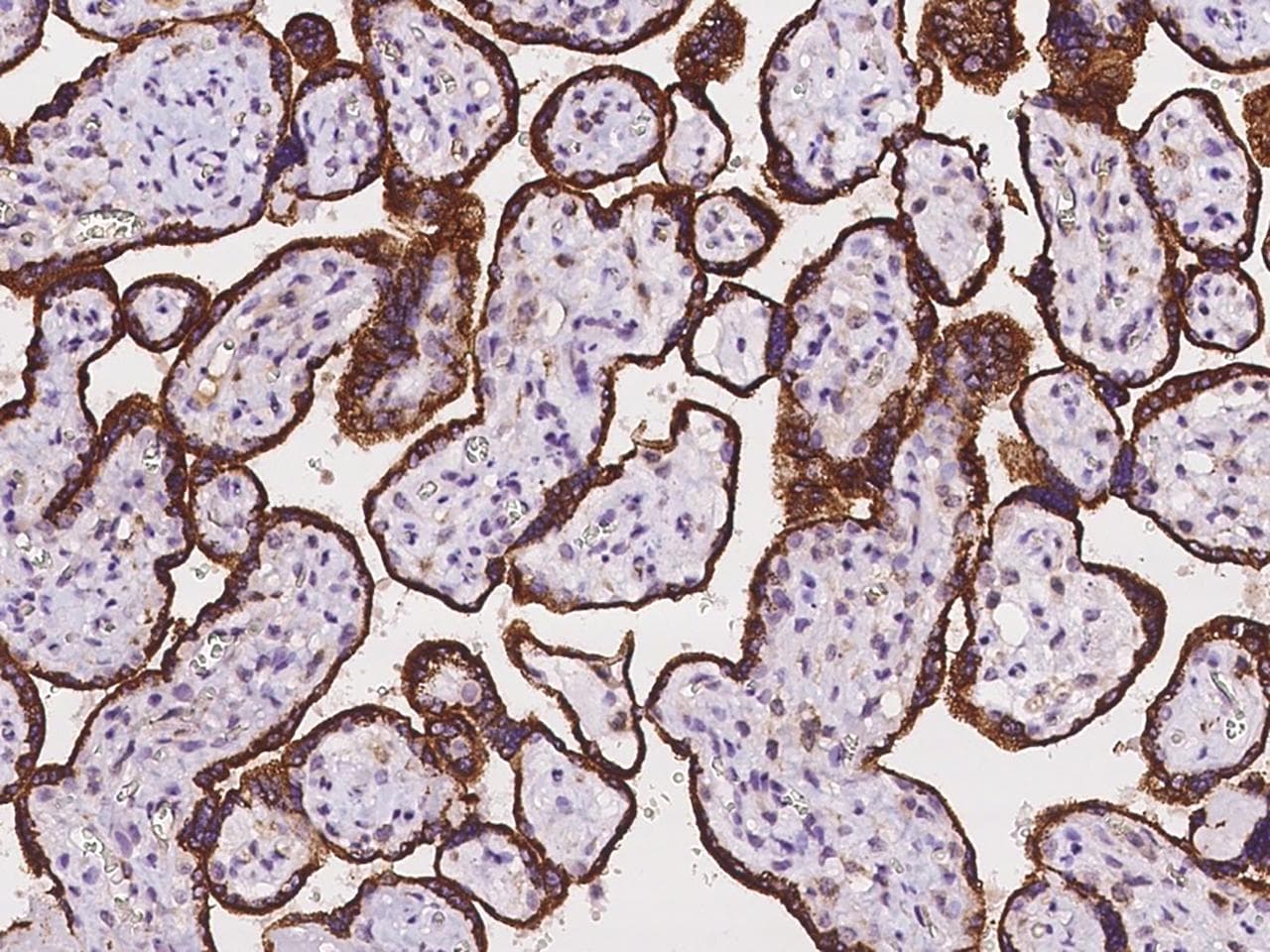 ADAM17 / TACE Antibody