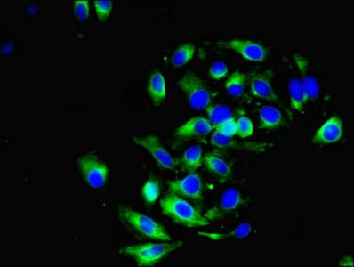DRD5 / Dopamine Receptor D5 Antibody (aa361-477)