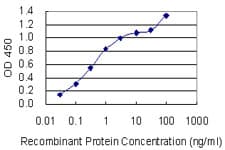 SGCD / Delta-Sarcoglycan Antibody (clone 3G10)