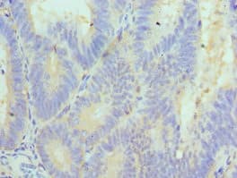 CUL5 / Cullin-5 Antibody (aa1-300)
