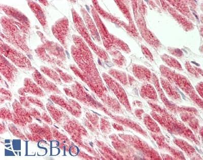 IHC-plus™ SPTLC1 / HSN1 Antibody (aa50-100)