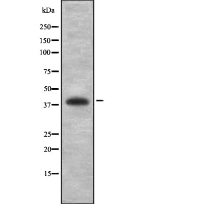 PCYT1A / CCT Alpha Antibody